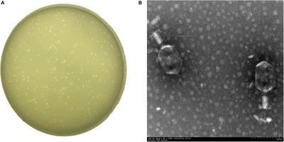 Combination Therapy of Phage vB_KpnM_P-KP2 and Gentamicin Combats Acute Pneumonia Caused by K47 Serotype Klebsiella pneumoniae